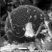 Unknown diatom (cingulum)